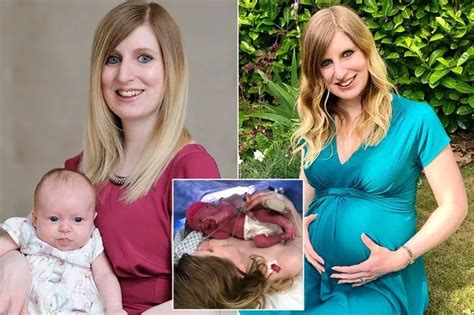 australian woman born with 2 vaginas|Woman shares what its like being born with two vaginas and no。